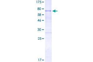 Image no. 1 for Homeobox A10 (HOXA10) (AA 1-393) protein (GST tag) (ABIN1306921)
