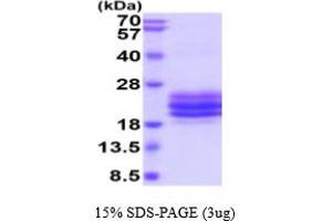 SDS-PAGE (SDS) image for CD79b Molecule, Immunoglobulin-Associated beta (CD79B) (AA 29-159) protein (His tag) (ABIN7281213)