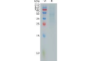 Human RHOC Protein, hFc Tag on SDS-PAGE under reducing condition.