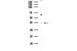 Western blot analysis of lysates from PC12 cells(LPS,4h treatment), using SLC39 Antibody at 1/1000 dilution.