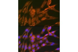 Immunofluorescence analysis of NIH-3T3 cells using 14-3-3 Theta Rabbit mAb (ABIN7265312) at dilution of 1:100 (40x lens).