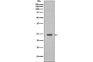 Western blot analysis of Rab9 expression in HepG2 cell lysate. (Recombinant RAB9A anticorps)
