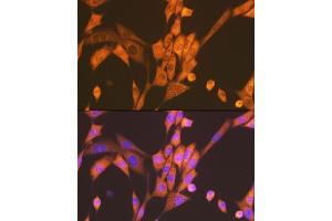 Immunofluorescence analysis of NIH-3T3 cells using Raptor Rabbit mAb (ABIN7269900) at dilution of 1:100 (40x lens).