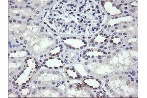 Image no. 1 for anti-Mdm4-binding Protein (MDM4) antibody (ABIN1499354)