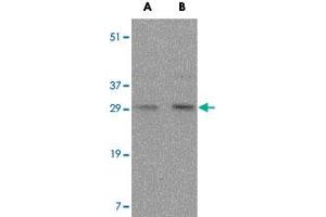 Western blot analysis of FAIM3 in rat liver tissue lysate with FAIM3 polyclonal antibody  at (A) 0. (RANKL anticorps  (Internal Region))