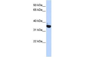 WB Suggested Anti-OR13C5 Antibody Titration:  0. (OR13C5 anticorps  (N-Term))