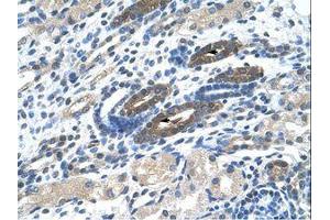 Image no. 1 for anti-BTB (POZ) Domain Containing 14A (BTBD14A) (AA 30-79) antibody (ABIN203337) (BTBD14A anticorps  (AA 30-79))