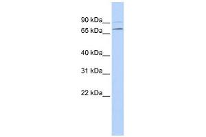 YTHDF3 antibody used at 1 ug/ml to detect target protein. (YTHDF3 anticorps  (N-Term))