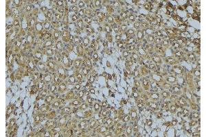 ABIN6273029 at 1/100 staining Mouse kidney tissue by IHC-P. (ACADS anticorps)