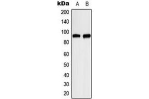 Western blot analysis of ITPKC expression in HeLa (A), RT4 (B) whole cell lysates. (ITPKC anticorps  (Center))