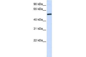 ALAS2 antibody used at 1 ug/ml to detect target protein. (ALAS2 anticorps  (C-Term))