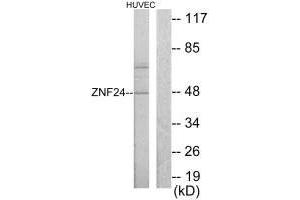 Western blot analysis of extracts from HUVEC cells, using ZNF24 antibody. (ZNF24 anticorps  (N-Term))