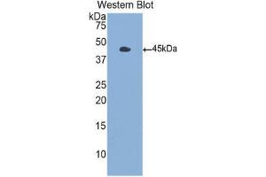 Western Blotting (WB) image for anti-Colony Stimulating Factor 2 (Granulocyte-Macrophage) (CSF2) (AA 18-144) antibody (ABIN1859034) (GM-CSF anticorps  (AA 18-144))