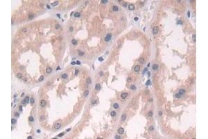 Detection of PSMD2 in Human Kidney Tissue using Polyclonal Antibody to Proteasome 26S Subunit, Non ATPase 2 (PSMD2)