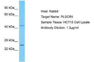 Host: Rabbit Target Name: PLSCR5 Sample Type: HCT15 Whole Cell lysates Antibody Dilution: 1. (PLSCR5 anticorps  (C-Term))