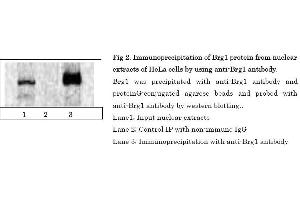 Western Blotting (WB) image for anti-SWI/SNF Related, Matrix Associated, Actin Dependent Regulator of Chromatin, Subfamily A, Member 4 (SMARCA4) (C-Term) antibody (ABIN2451926)