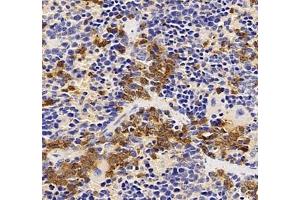 Immunohistochemistry of paraffin embedded mouse Immune spleen using CXCR1 (ABIN7073465) at dilution of 1: 2000 (400x lens)