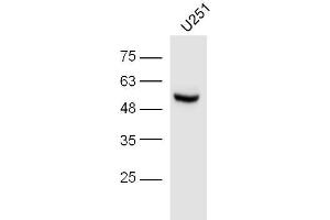 U251 lysates probed with IRF3 (Ser396) Polyclonal Antibody, unconjugated  at 1:300 overnight at 4°C followed by a conjugated secondary antibody at 1:10000 for 60 minutes at 37°C.