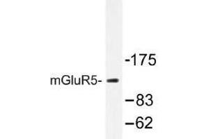 Image no. 1 for anti-Glutamate Receptor, Metabotropic 5 (GRM5) antibody (ABIN317705) (Metabotropic Glutamate Receptor 5 anticorps)
