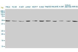 ENO2 monoclonal antibody (M01), clone 1A3.