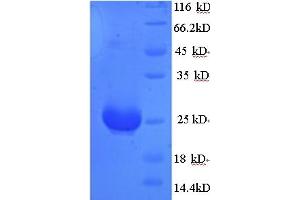 SDS-PAGE (SDS) image for Anti-Mullerian Hormone (AMH) (AA 450-552) protein (His tag) (ABIN5713220)