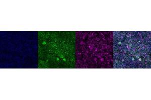 Immunohistochemistry (IHC) image for anti-Tryptophan Hydroxylase 2 (TPH2) antibody (ABIN7456102)