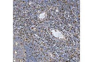 IHC analysis of HSF1 using anti-HSF1 antibody (ABIN7602894).