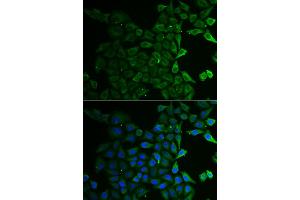 Immunofluorescence analysis of HeLa cells using C21orf33 antibody. (C21orf33 anticorps)