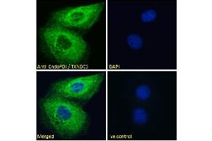 ABIN185279 Immunofluorescence analysis of paraformaldehyde fixed HeLa cells, permeabilized with 0. (TXNDC5 anticorps  (C-Term))