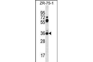 STX2 Antibody (Center) (ABIN656401 and ABIN2845695) western blot analysis in ZR-75-1 cell line lysates (35 μg/lane). (STX2 anticorps  (AA 123-152))
