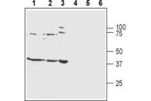 Western blot analysis of rat brain membranes (lanes 1 and 4), mouse brain membranes (lanes 2 and 5) and human SH-SY5Y neuroblastoma cell lysates (lanes 3 and 6): - 1-3. (KCNJ10 anticorps  (C-Term, Intracellular))