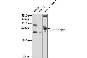 Western blot analysis of extracts of various cell lines, using TCTP/TCTP/TPT1 antibody  at 1:1000 dilution. (TPT1 anticorps  (AA 1-172))