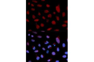 Immunofluorescence (IF) image for anti-Cardiac Troponin C (TNNC1) (AA 1-160) antibody (ABIN6219070) (TNNC1 anticorps  (AA 1-160))
