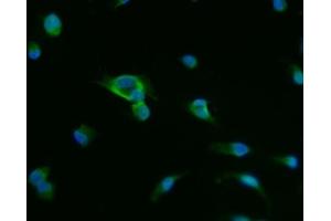 IF analysis of PAP/ACP3 using anti-PAP/ACP3 antibody (ABIN7600122).