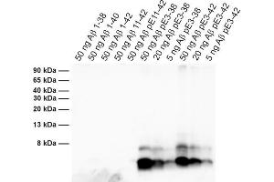 Detection of different synthetic Abeta species (dilution 1 : 1000). (Abeta-pE3 anticorps)