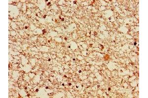 Immunohistochemistry of paraffin-embedded human brain tissue using  at dilution of 1:100 (LRRK2 anticorps  (AA 2029-2275))