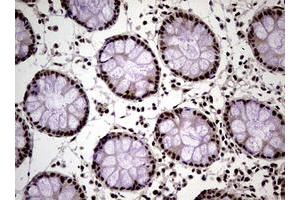 Image no. 20 for anti-Nibrin (NBN) (AA 183-460) antibody (ABIN1491058)