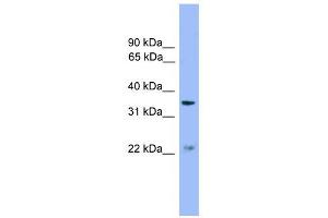 ZDHHC21 antibody used at 1 ug/ml to detect target protein. (ZDHHC21 anticorps  (Middle Region))