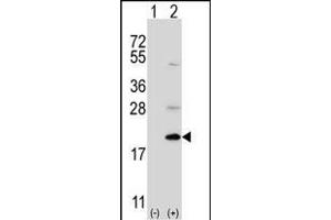 Western blot analysis of Ufc1 (arrow) using rabbit polyclonal Ufc1 Antibody (C-term) (ABIN650703 and ABIN2839221). (UFC1 anticorps  (C-Term))