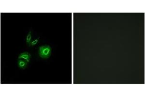 Immunofluorescence analysis of A549 cells, using MET Antibody. (c-MET anticorps  (AA 276-325))