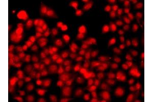 Immunofluorescence analysis of  cells using TH antibody (ABIN6128823, ABIN6149105, ABIN6149106 and ABIN6223361). (THAP1 anticorps  (AA 1-213))