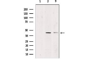 Western blot analysis of extracts from various samples, using CADM3 Antibody. (CADM3 anticorps  (Internal Region))