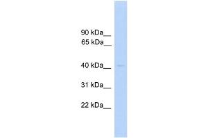 WB Suggested Anti-PRKAR1A Antibody Titration: 0.