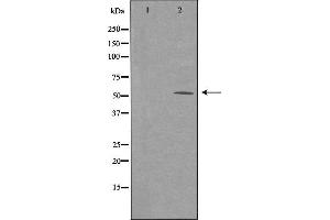 Western blot analysis of extracts from HeLa cells using ARMC6 antibody. (ARMC6 anticorps  (C-Term))