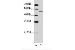 Image no. 2 for anti-Zinc Finger (CCCH Type), RNA-Binding Motif and serine/arginine Rich 2 (ZRSR2) (AA 369-418) antibody (ABIN202635) (ZRSR2 anticorps  (AA 369-418))