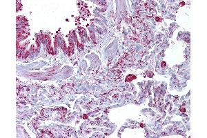 Anti-GABRB3 antibody IHC of human lung. (GABRB3 anticorps  (AA 180-229))