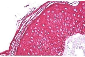 Anti-Cytokeratin 1 / Keratin 1 antibody IHC staining of human skin. (Cytokeratin 1 anticorps  (Internal Region))