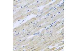 Immunohistochemistry of paraffin-embedded rat heart using CLIP1 antibody. (CLIP1 anticorps  (AA 1228-1427))