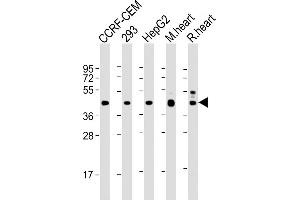 All lanes : Anti-VEGFC at 1:2000 dilution Lane 1: CCRF-CEM whole cell lysate Lane 2: 293 whole cell lysate Lane 3: HepG2 whole cell lysate Lane 4: mouse heart lysate Lane 5: rat heart lysate Lysates/proteins at 20 μg per lane. (VEGFC anticorps)