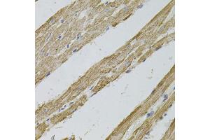 anti-Regenerating Islet-Derived 3 alpha (REG3A) (AA 27-175) antibody